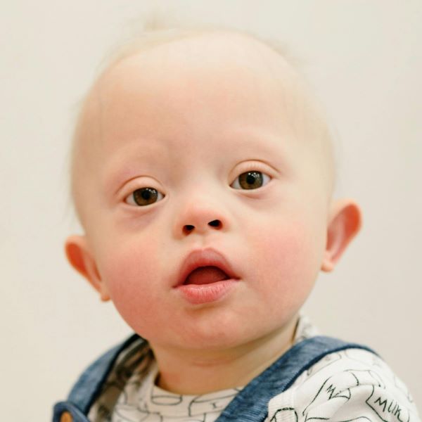 Luisterkind Methode voor kinderen met Downsyndroom